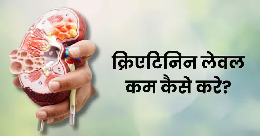 क्रिएटिनिन के स्तर को स्वाभाविक रूप से कम करने के 12 घरेलू उपाय